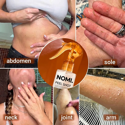 Body Peel Spray - Kojic + Turmeric