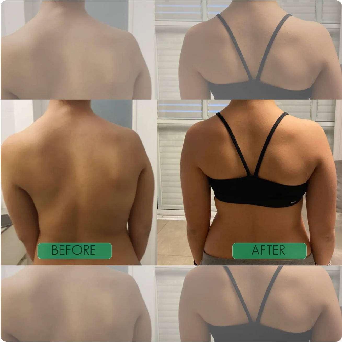 𝗜𝗻𝘀𝘁𝗮𝗻𝘁 𝗣𝗼𝘀𝘁𝘂𝗿𝗲 𝗖𝗼𝗿𝗿𝗲𝗰𝘁𝗼𝗿