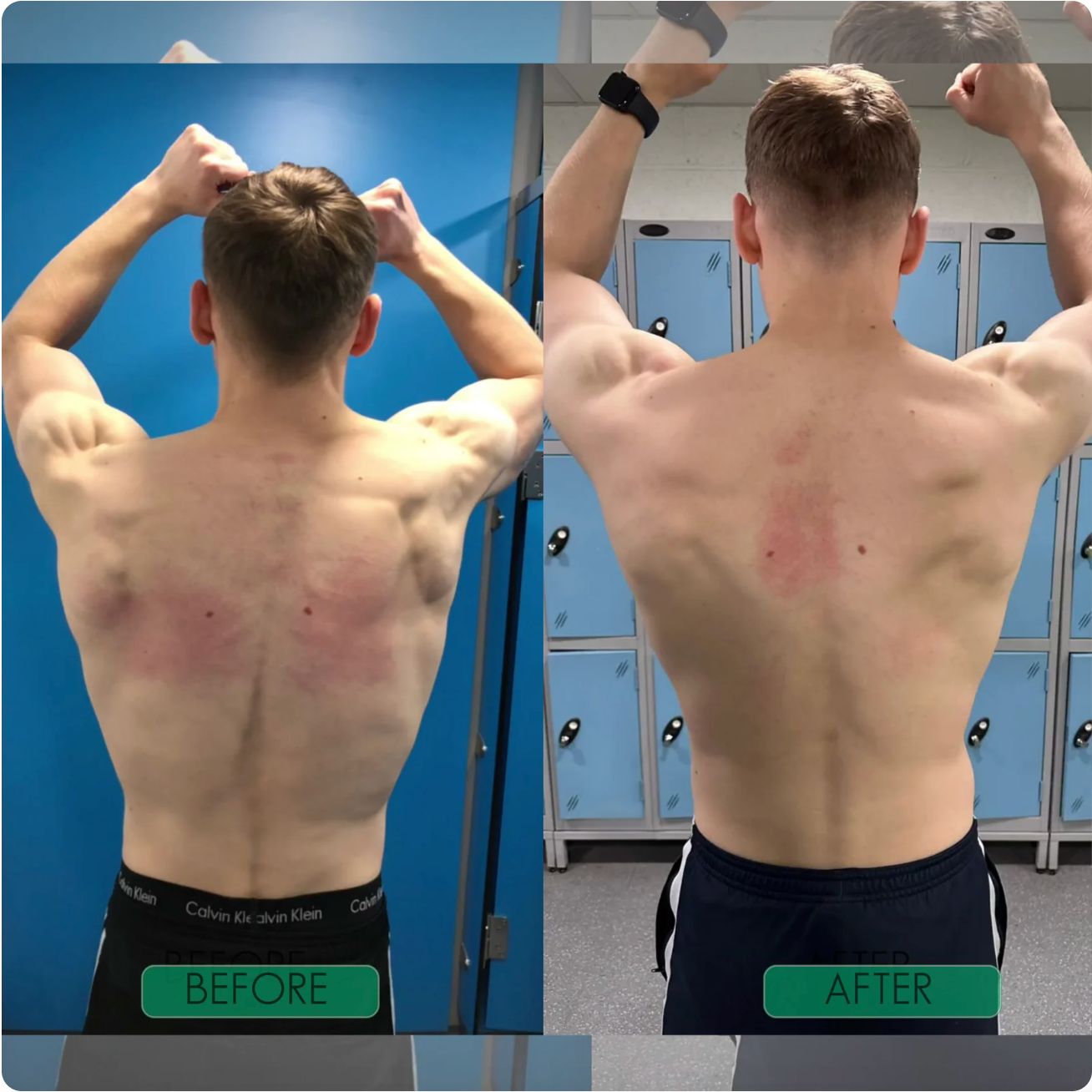 𝗜𝗻𝘀𝘁𝗮𝗻𝘁 𝗣𝗼𝘀𝘁𝘂𝗿𝗲 𝗖𝗼𝗿𝗿𝗲𝗰𝘁𝗼𝗿